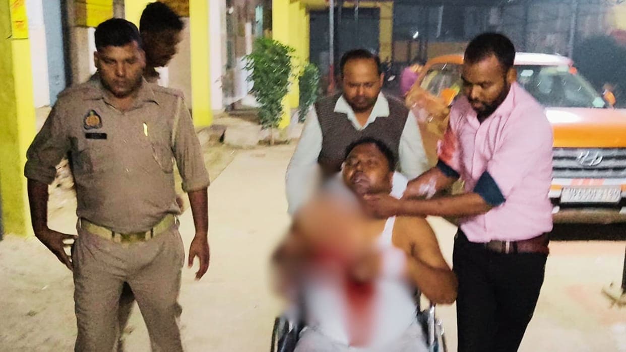 वाराणसी में निजी अस्पताल के निदेशक के भाई पर जानलेवा हमला, घर में घुसकर रेता गला