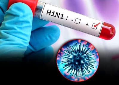 लखनऊ में H1N1 के 6 नए मरीज मिले, एक्टिव केस 79