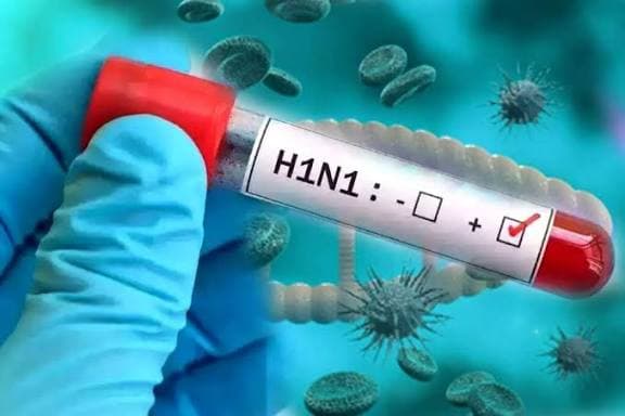लखनऊ में H1N1 के 9 नए मामले मिले, स्वास्थ्य विभाग अलर्ट